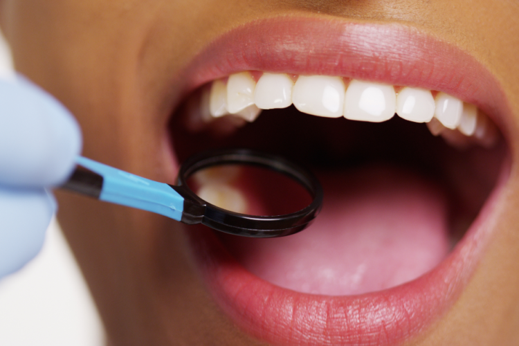 Oral Cancer Detection at St. Joseph Dentistry.